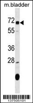 OSGIN1 Antibody (C-term)