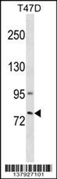 GLB1L3 Antibody (C-term)