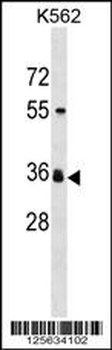 ORNT2 Antibody (Center)