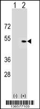PLEKHA1 Antibody (Center)