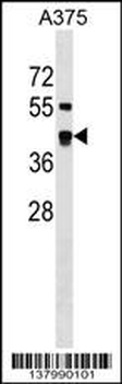 SDSL Antibody (N-term)
