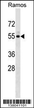 UNC5CL Antibody (Center)