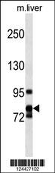 CCNF Antibody (Center)