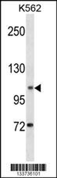 ANO1 Antibody (Center)