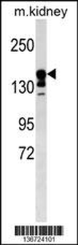 ABCC9 Antibody (Center)