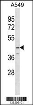 SERPINB12 Antibody (Center)