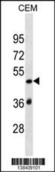 SP140L Antibody (Center)
