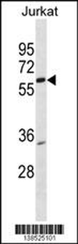 PKNOX2 Antibody (Center)
