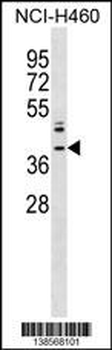 ZNF75A Antibody (Center)
