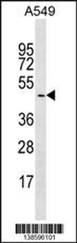 GYG2 Antibody (C-term)