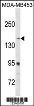 RRBP1 Antibody (C-term)