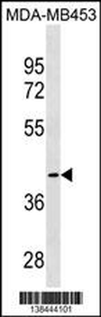 CCBL1 Antibody (C-term)