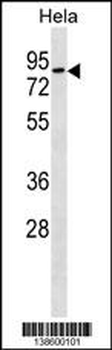 RHOT1 Antibody (N-term)