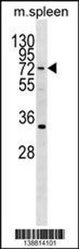 HIC2 Antibody (Center)