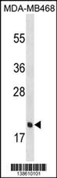 PGLYRP1 Antibody (C-term)