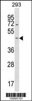 STARD7 Antibody (N-term)