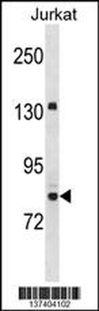 UHRF2 Antibody (Center)
