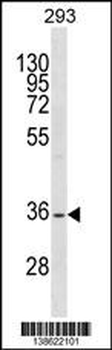 SSBP2 Antibody (N-term)