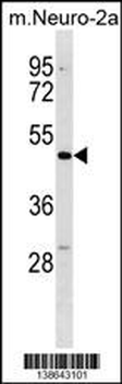 Mouse Dcdc2 Antibody (C-term)