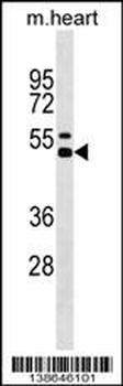 Mouse Il12b Antibody (Center)