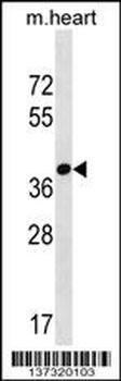 FBXO22 Antibody (C-term)