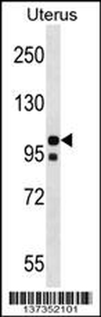 NLRP4 Antibody (N-term)