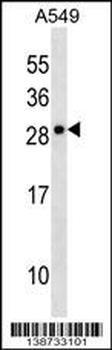 CLCF1 Antibody (N-term)