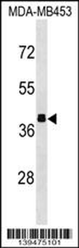 ALDOB Antibody (N-term)