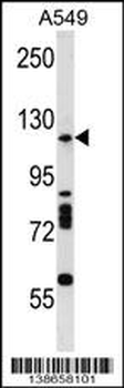 Mouse Rnasen Antibody (Center)