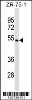 CHST5 Antibody (C-term)