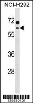 MCCC2 Antibody (C-term)