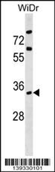 ARPC2 Antibody (C-term)
