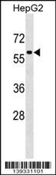 TFEB Antibody (Center)