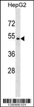 NR1H4 Antibody (N-term)