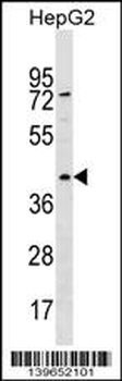 RBMXL1 Antibody (Center)