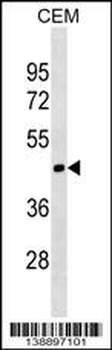 MOCS1 Antibody (N-term)
