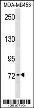 KAL1 Antibody (N-term)