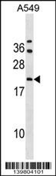 GRPEL2 Antibody (N-term)