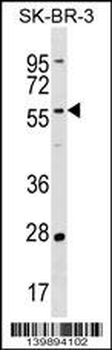 TAF6L Antibody (N-term)