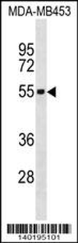 IL5RA Antibody (C-term)