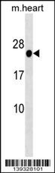 HOXB7 Antibody (Center)