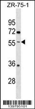 ENTPD5 Antibody (C-term)