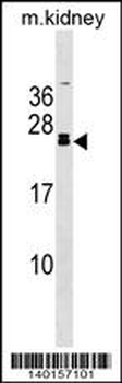 FGF20 Antibody (C-term)