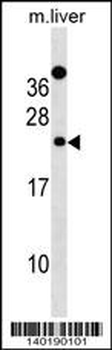 Mouse Derl2 Antibody (C-term)