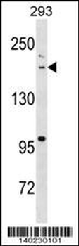 BAZ1B Antibody (N-term)