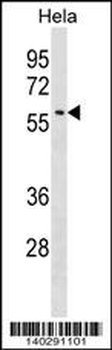 Mouse Selenbp1 Antibody (C-term)