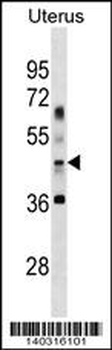 APG4B Antibody (Center G254)