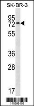 MBD4 Antibody(Center)