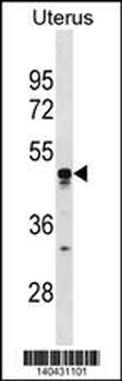 TIMD4 Antibody(C-term)