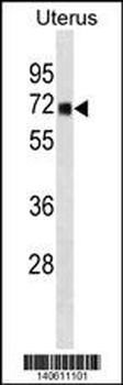 TRMT1 Antibody(N-term)